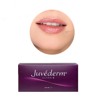 唇の注入口のためのJuvedermの形成外科の皮膚Hyaluronic酸