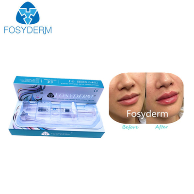 唇のセリウムの証明のための1ml DermのHyaluronic酸の皮膚注入口