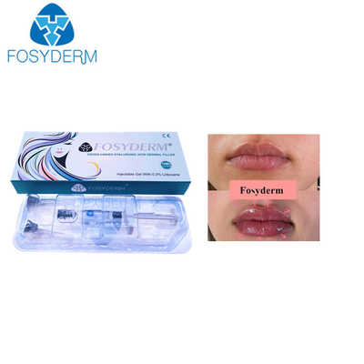 唇のセリウムの証明のための1ml DermのHyaluronic酸の皮膚注入口