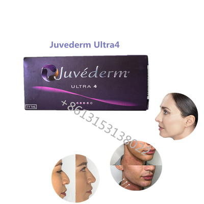 唇の十分のJuvederm Ultra4 Allerganの唇のための皮膚注入口のJuvederm HAの注入口