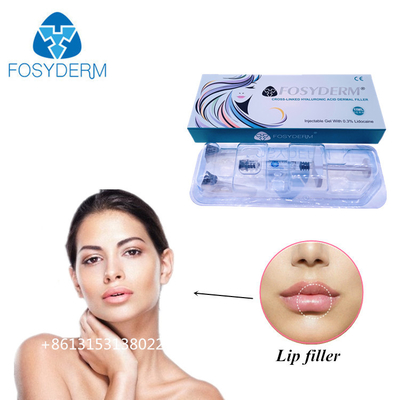 Fosyderm 1ml ヒアルロン酸 唇のサイズを増やすための皮膚充填剤注射