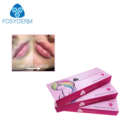 Fosyderm 1ml ヒアルロン酸 唇のサイズを増やすための皮膚充填剤注射
