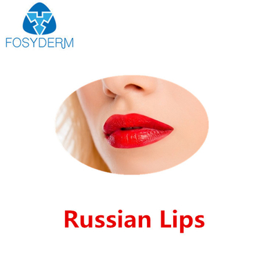 Juvedermリドカインが付いている超3つのHyaluronic酸の皮膚注入口のロシアの唇