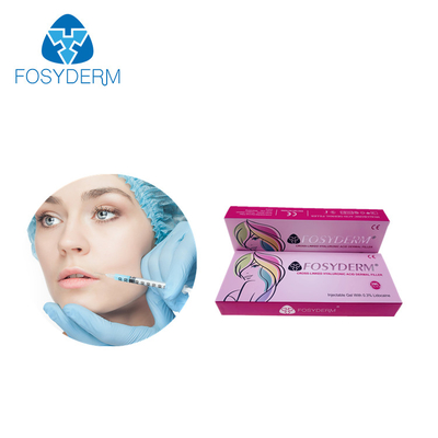 Fosyderm 2mlの皮膚唇の注入口のHyaluronic酸の注入の皮膚注入口