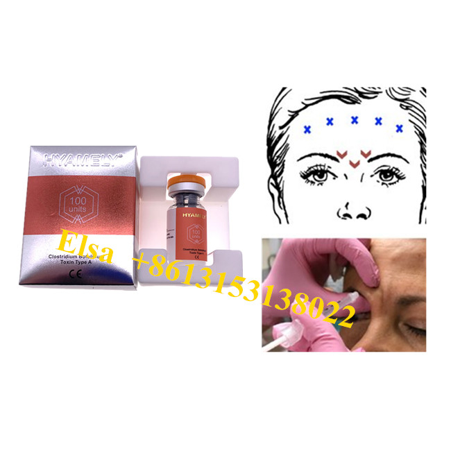 Hyamelyのボツリヌス菌の毒素ののスキン ケア プロダクト反しわはInjecitonを粉にする