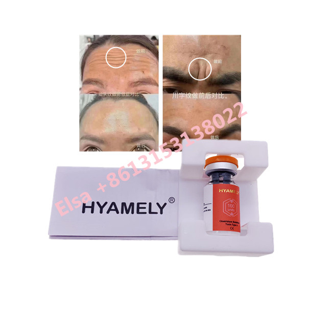 Hyamely のボツリヌス菌の毒素韓国の100uの化粧品をタイプするため