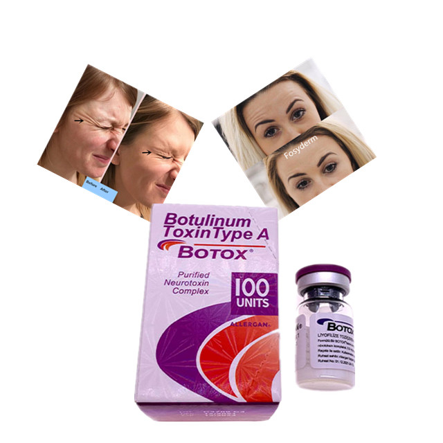 Allerganのボツリヌス菌の毒素のタイプ 100の単位の皮膚注入口のHyaluronic酸