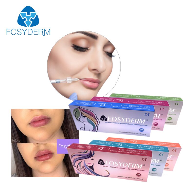 Supply Dermal Fillers Hyaluronic Acid Gel Dermal Filler Injection