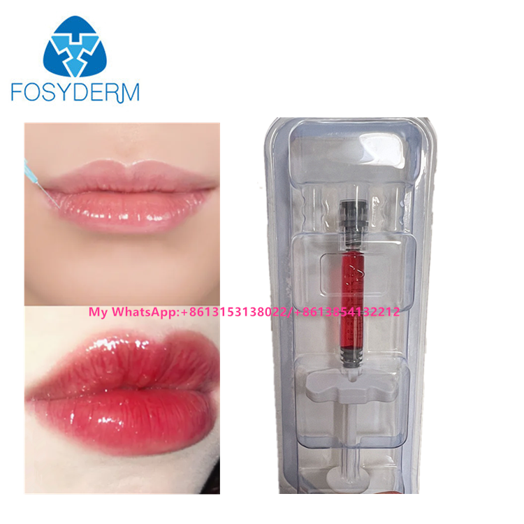 レッドリップフィラー ヒアルロン酸 ビタミンB12の皮膚フィラー注入 1ml