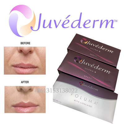 JuvedermのHyaluronic酸の顔の注入口長続きがするUltra3 Ultra4 Volumaの注入