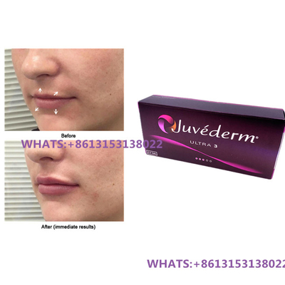 Juvederm 唇用皮膚フィルラー Juvederm Ultra3 Ultra4 フィルラー 前注入注射器