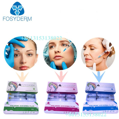 Fosydermの唇のセリウムのための皮膚注入口のHyaluronic酸の注入24mg/ml HA