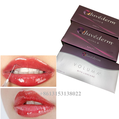 Juvederm Voluma ヒアルロン酸皮膚フィルラージェル 24mg/Ml皮膚フィルラー