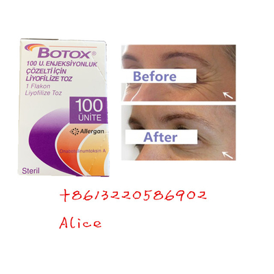 反老化する反しわのボツリヌス菌の毒素Allerganはの粉をタイプする