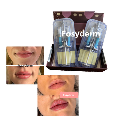 JuvedermのvolbellaのHyaluronic酸の唇の注入口の十字は24mgをつないだ