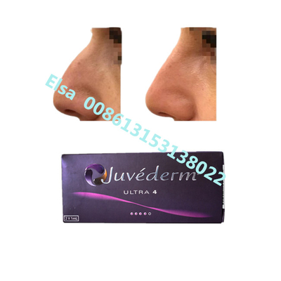 Juvederm ナトリウム 超4 ボリュマ 皮膚 フィルラー