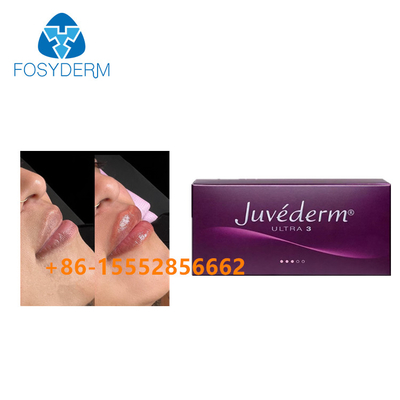 唇の強化の皮膚注入口のJuvederm 2mlのHyaluronic酸の注入