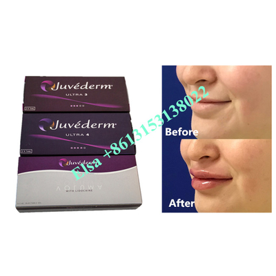 Voluma ヒアルロン酸 Fosyderm 皮膚フィラー注射 24mg/ml