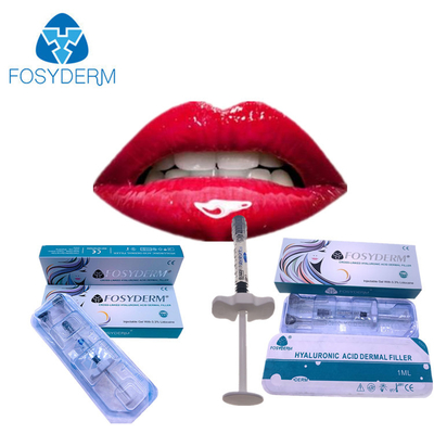 唇よりふくよかなHaの注入口の注入Fosyderm 1ml Derm