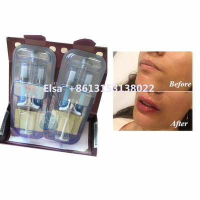 美容剤 Juvederm Voluma ヒアルロン酸 顔料 HA インジェクション
