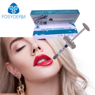 Fosyderm 1ml DermのHyaluronic酸の皮膚注入口の唇のよりふくよかな注入