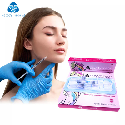 FosydermのHyaluronic酸の注射可能な皮膚注入口の唇