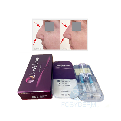 表面唇は皮膚注入口のJuvederm Ultra3のHyaluronic酸のゲルを架橋結合した