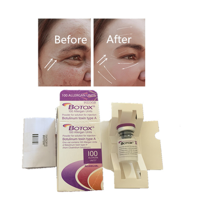 Allergan の反しわの反老化のためのボツリヌス菌の毒素の注入