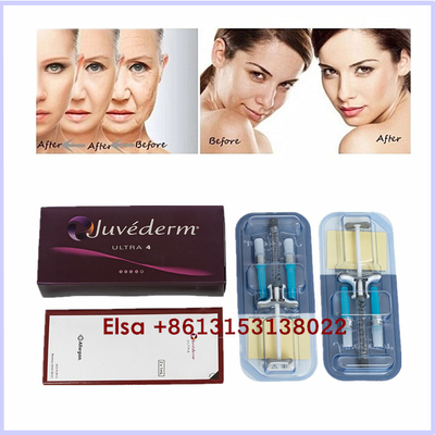 審美的なプロダクトJuvederm Ultra3 Ultra4 VolumaのHyaluronic酸の皮膚注入口のゲルの注入