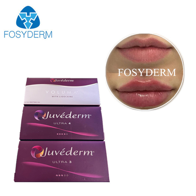 Juvederm Dermal Filler インジェクション クロスリンク ヒアルロン酸 HA ジェル フェイス フィラー 前注入注射器