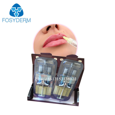 Juvederm 皮膚充填剤 注射 線やしわに対する ヒアルロン酸 唇充填剤