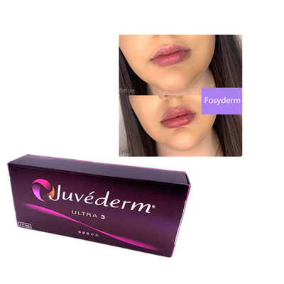 2ml Juvederm ヒアルロン酸 皮膚充填剤 眉毛 唇 アルトラ 3