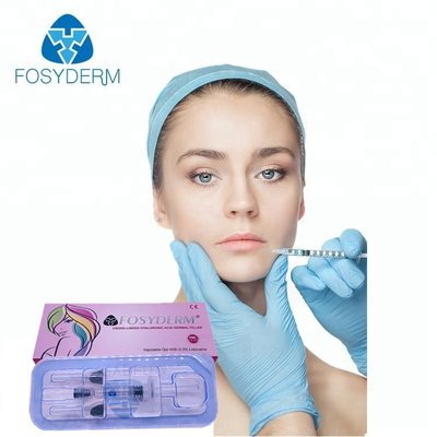 唇の充填剤 唇の満度拡大剤 2ml 皮膚の充填剤 Fosyderm HA 充填剤 注射