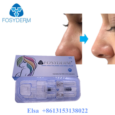Fosyderm 深層 2ml 皮膚充填剤 顔の若返しのための HA 充填剤
