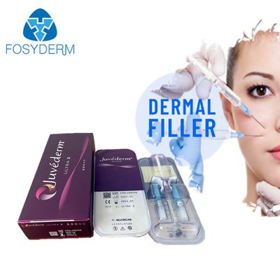 Juvederm Ultra3 インジェクタブル 皮膚用 フィルラー ヒアルロン酸 顔内注射