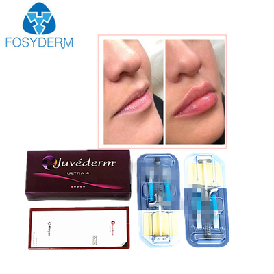 Juvederm ヒアルロン酸 皮膚充填剤 顔に注入する