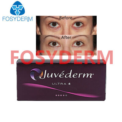 Juvederm ヒアルロン酸 唇と顔のリフティングのための皮膚充填剤 24mg
