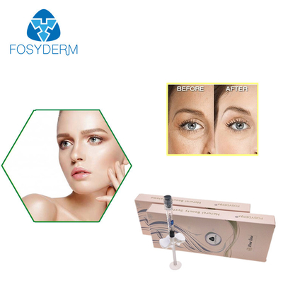 Fosydermの十字は目のしわのためのHAの注入口2mlの微妙な一線Hyaluronic酸をつなぎました
