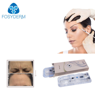 前に唇の十分のFosydermの満たされた架橋結合された注入口
