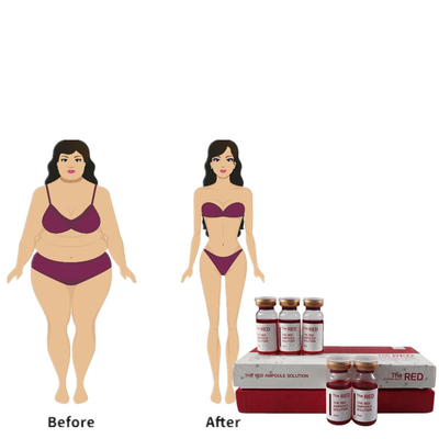 Lipo Meso赤いLipo緩いLipolytic Mesotherapyの注入