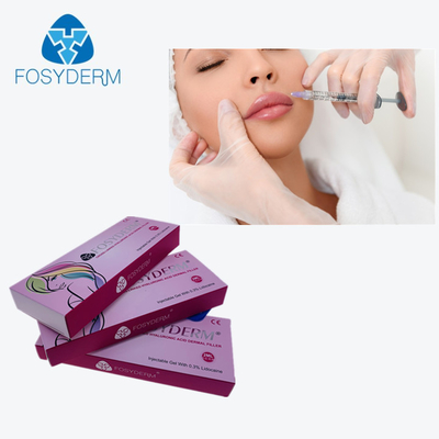 唇の強化を達成する十字つながれたHAの皮膚注入口2Ml Dermは注入する