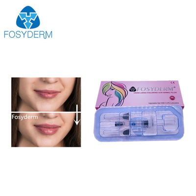 2ml フィラー ヒアルロン酸 皮膚フィルラー 顔 鼻 唇 拡大 24mg/ml