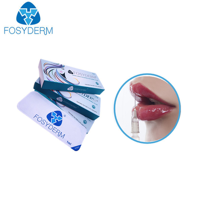 リドカインが付いているMg 1.1 MlのDermのHyaluronic酸の注入口の唇の強化24