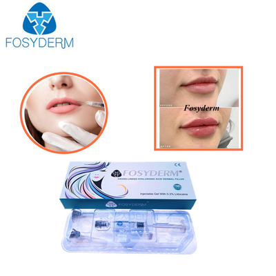 1.1 ml DermラインHyaluronic酸の注射可能な皮膚注入口の唇の強化
