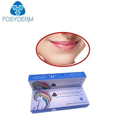 微笑ラインHyaluronic酸の皮膚注入口の容積のDermラインLyftのリドカインの皮膚注入口