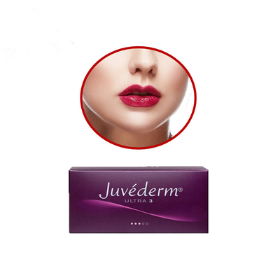 Juvedermリドカインが付いている超3つのHyaluronic酸の皮膚注入口のロシアの唇