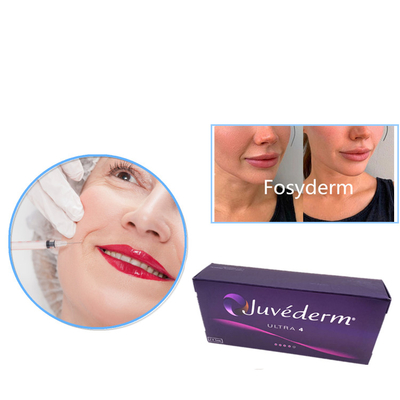 Juvederm超3つの超4つのVoluma HAの皮膚注入口のゲルの注入