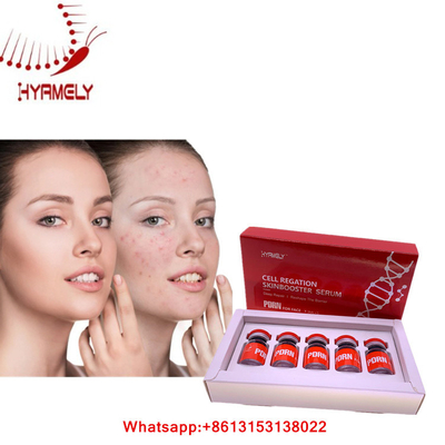 皮の再生のHyamelyの顔の注入MesotherapyのためのPDRNの血清
