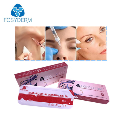 顔HAの皮膚注入口注射可能なFosyderm 2mlを持ち上げる唇の盛り土の頬